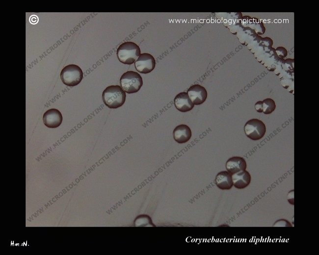 corynebacterium diphtheriae colonies close-up